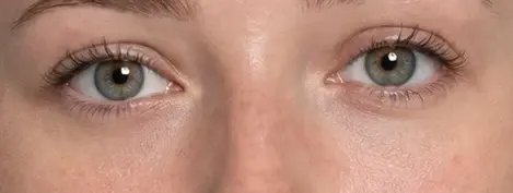 The same woman's face three times, cropped to the eyes. In the original the outer eye corners sit above the inner ones; in the second photo they were digitally moved level with them, and in the third below them. The corner line of each eye is drawn on every photo.