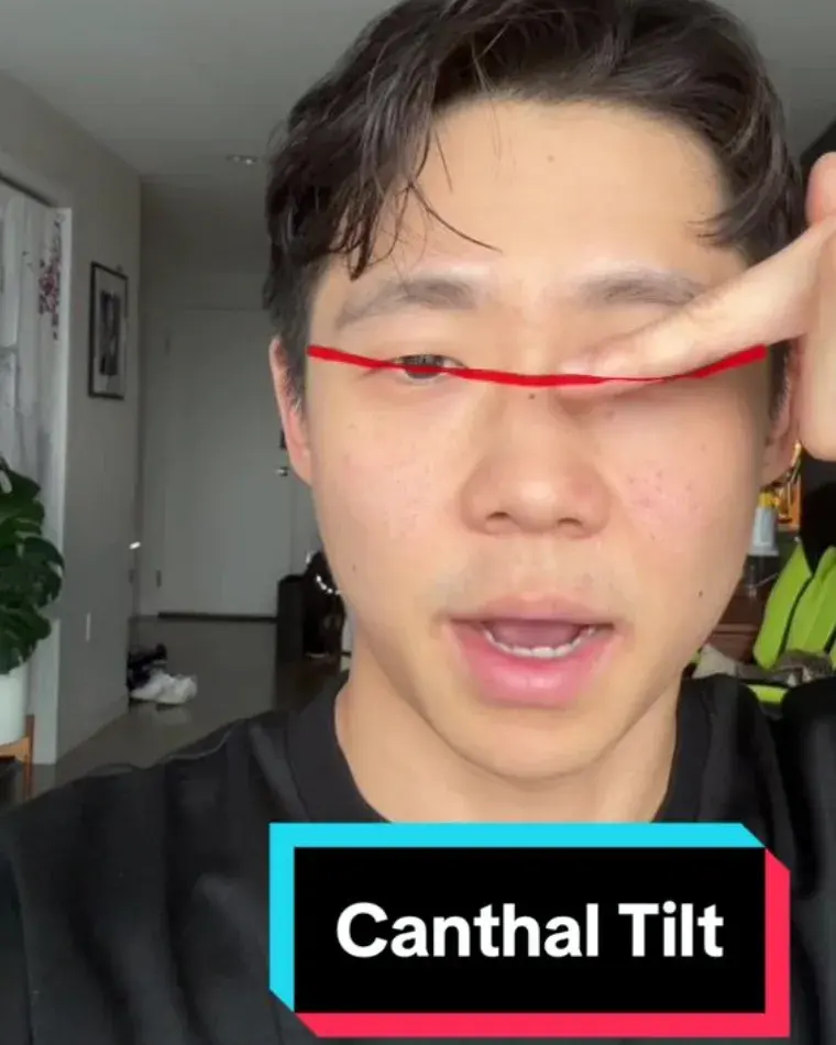 A doctor on TikTok with the canthal tilt filter drawing a red line through his eye corners